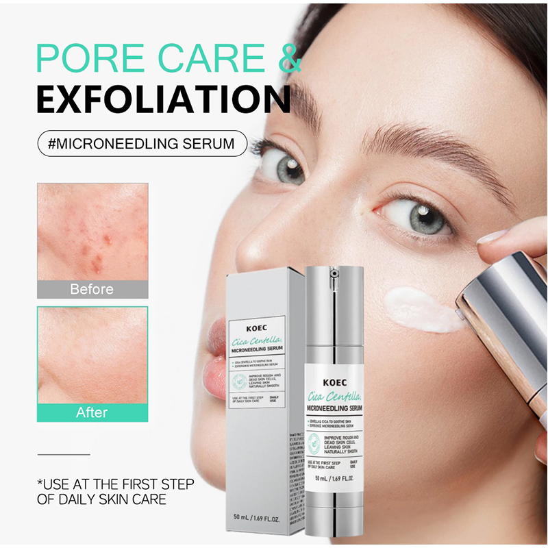 Soothing Microneedle Serum, Ce - огляд і ціна Skincare Centella